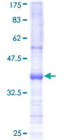 12.5% SDS-PAGE Stained with Coomassie Blue.